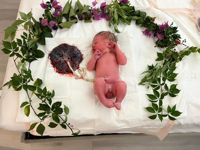 Newborn baby laying next to placenta attached by cod during delayed cord clamping.